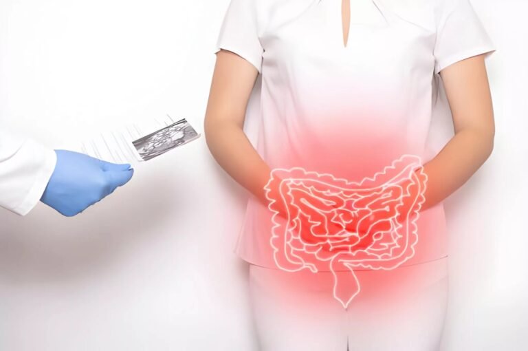 Infectious Colitis: When Infection Leads to Colon Inflammation