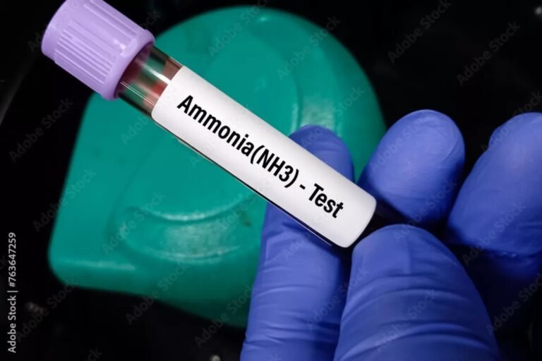Hyperammonemia: Causes, Symptoms, Diagnosis & Treatment