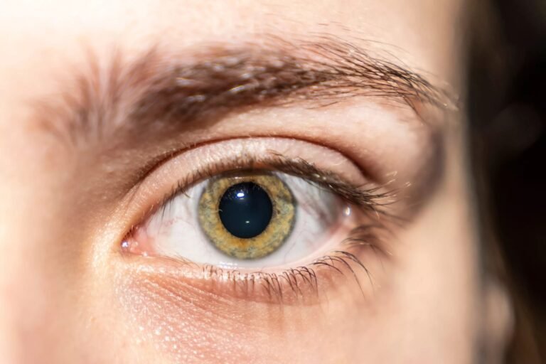 Adie’s Pupil: Causes, Symptoms, and Diagnosis