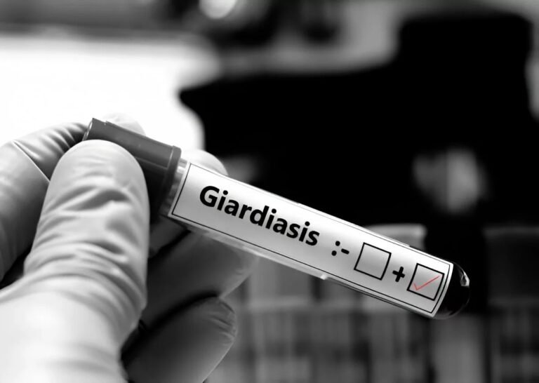 Chronic Giardiasis: Causes, Symptoms, and Management
