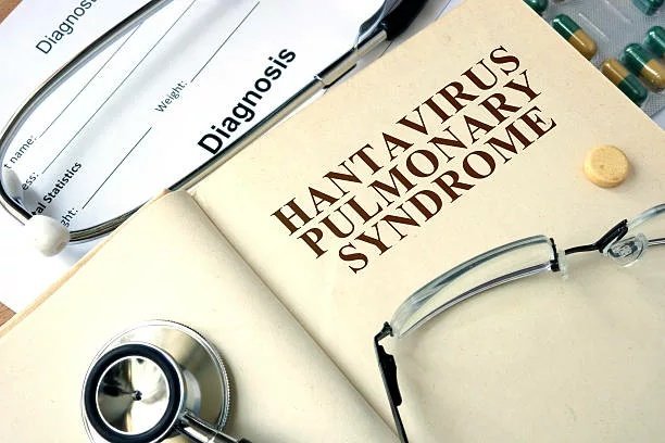 Hantavirus Pulmonary Syndrome: Causes, Risks & Prevention