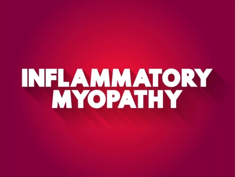 Inflammatory Myopathy (Myositis): Muscle Inflammation You Shouldn’t Ignore