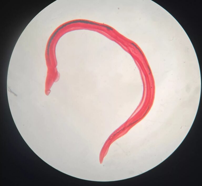 Schistosomiasis: Understanding Causes, Symptoms & Prevention