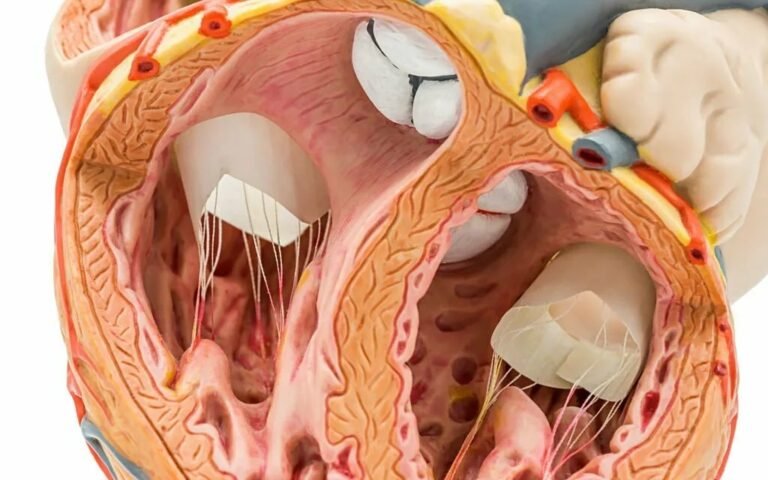 Infective Endocarditis: The Silent Heart Threat
