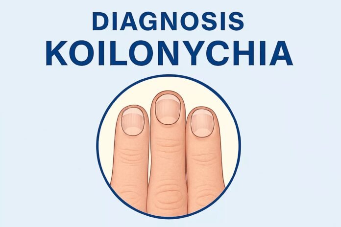 koilonychia-spoon-nails-why-your-nails-l