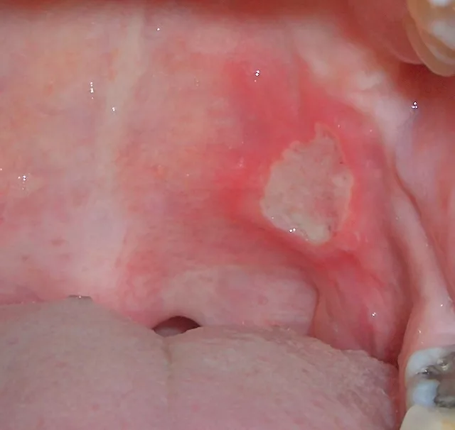 Picture 2