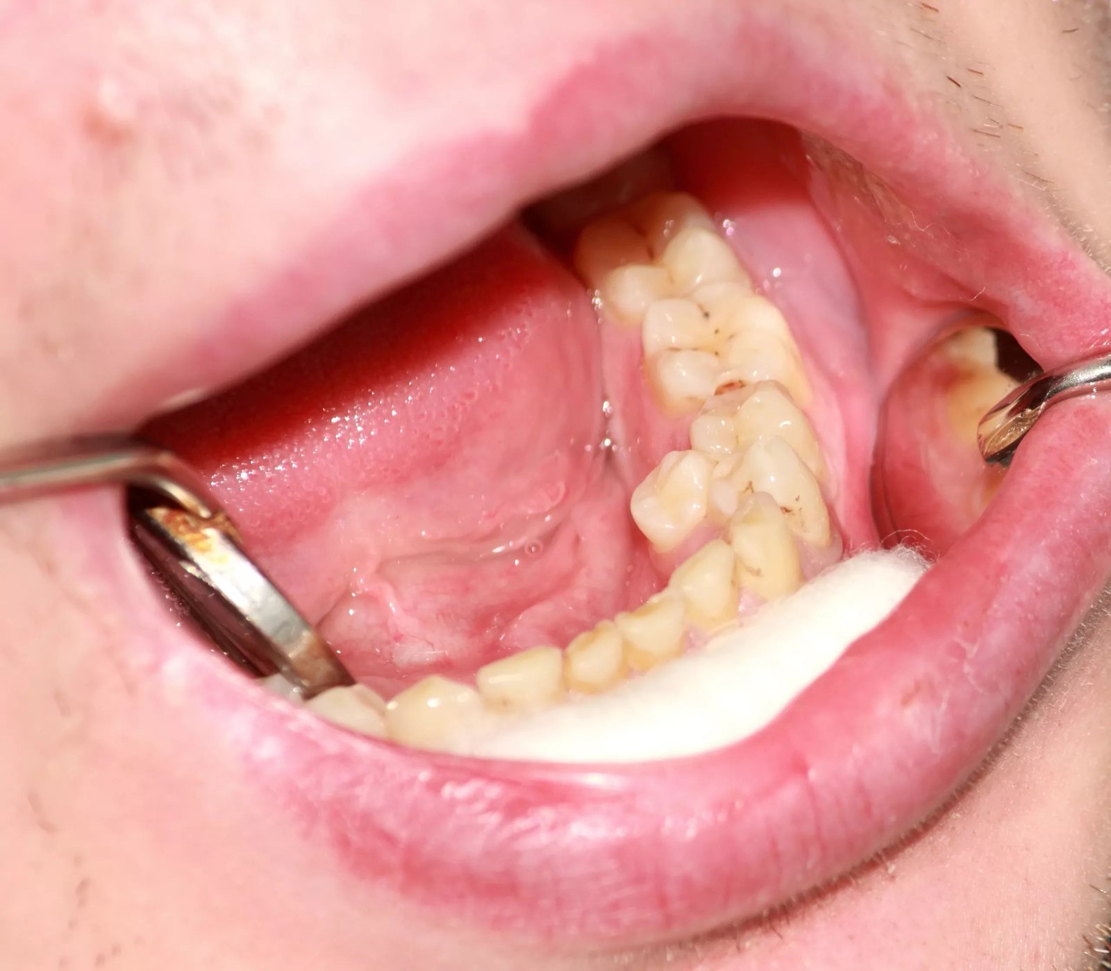 Picture 2