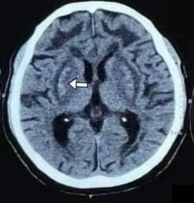 Picture 2