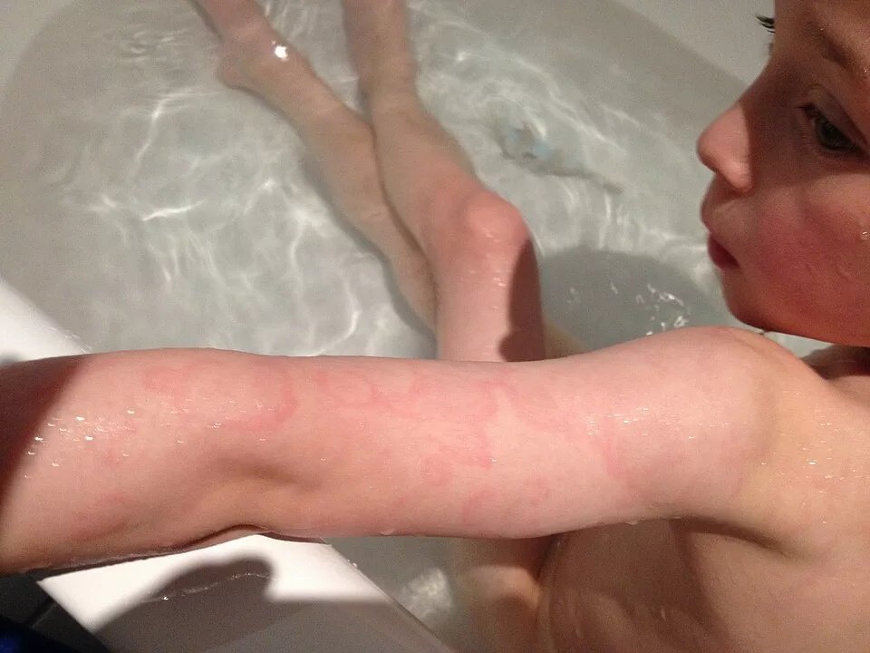 Picture 2