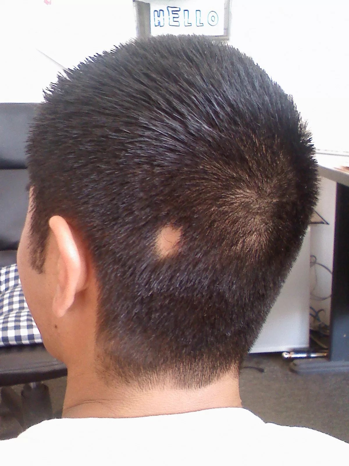 Picture 2