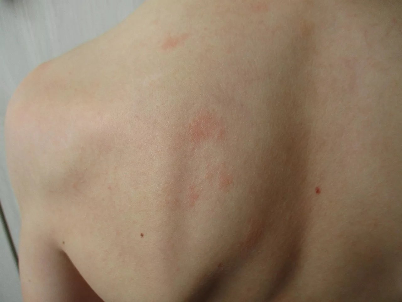 Picture 2