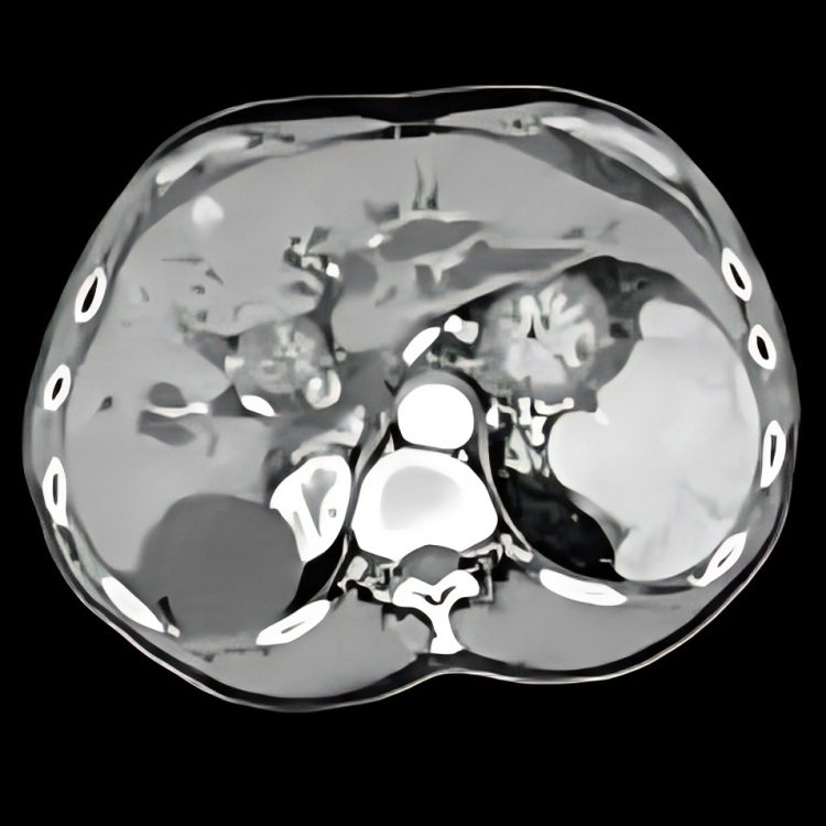 Picture 2