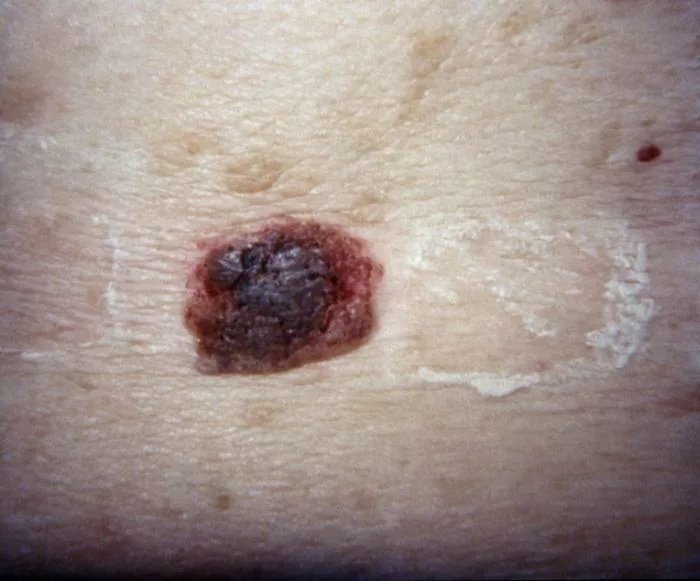 Picture 2