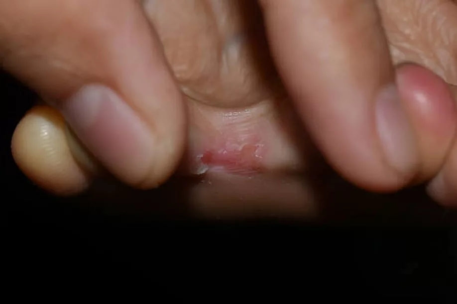 Picture 2