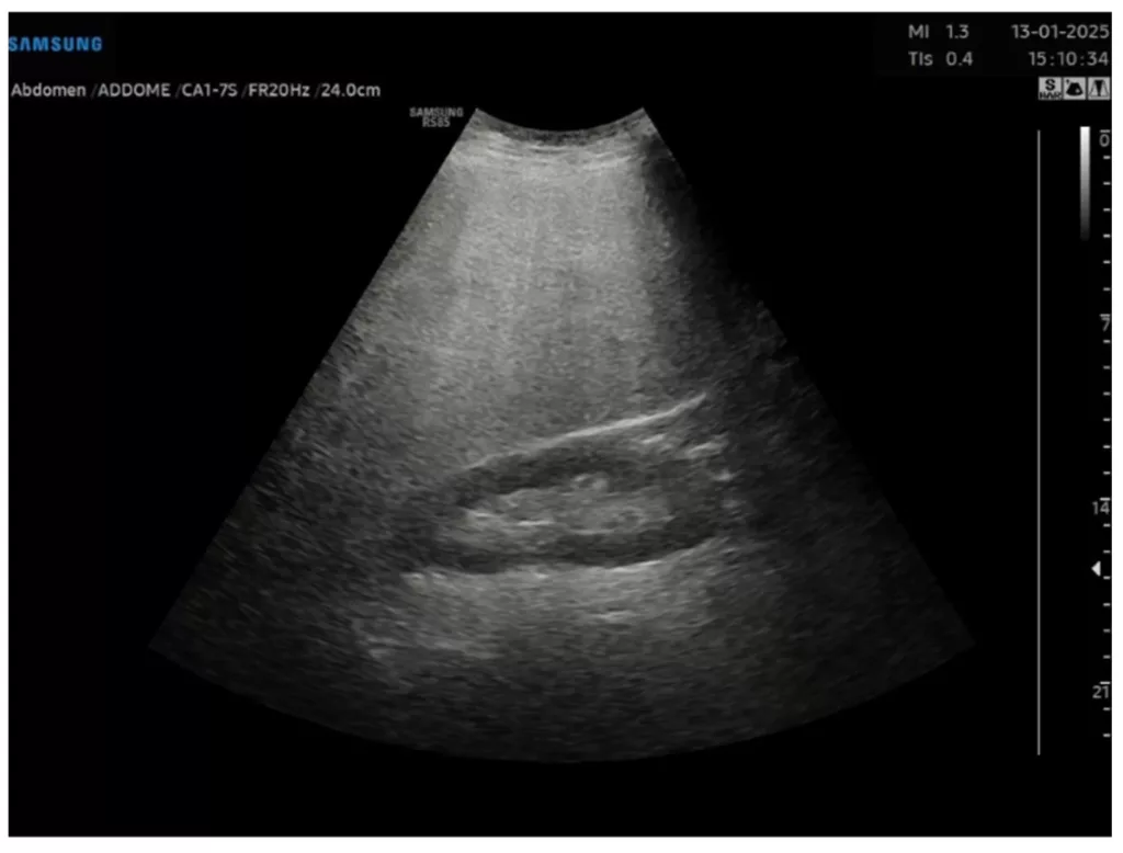 Picture 3