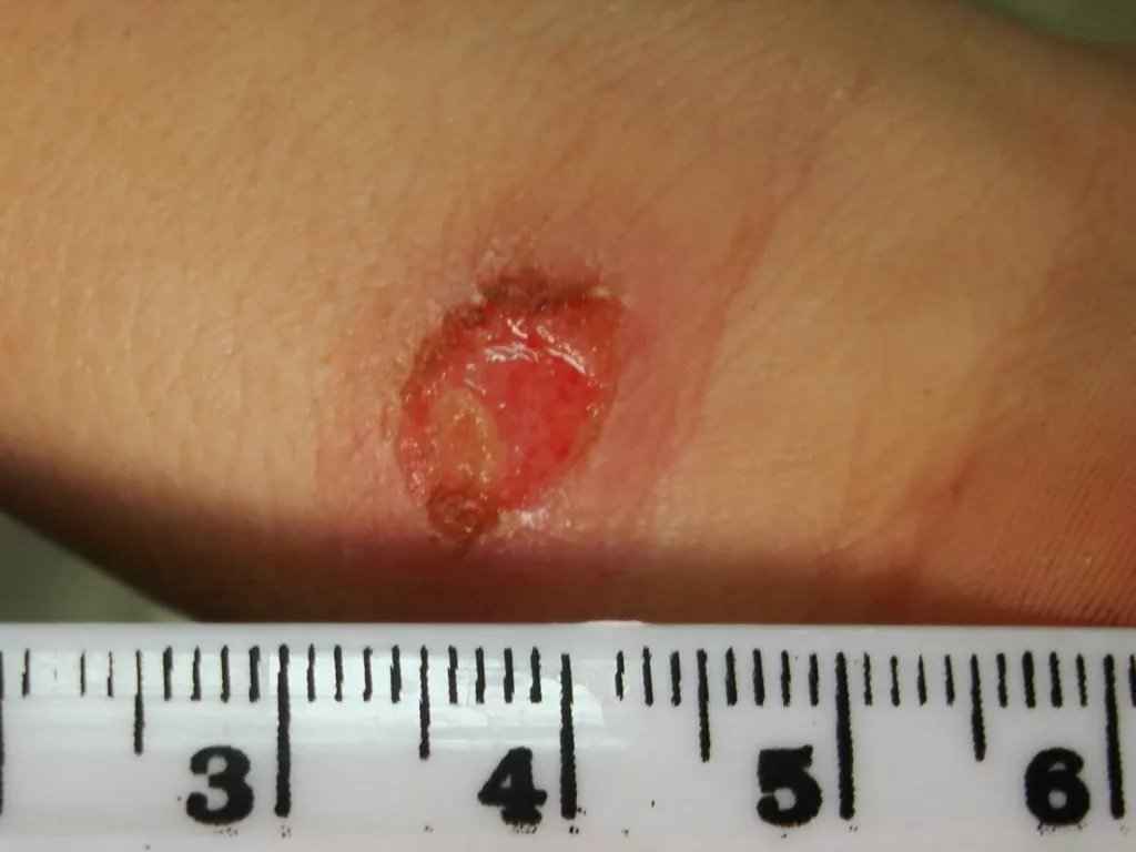 Picture 3