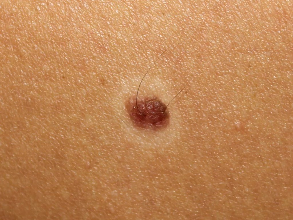 Picture 3