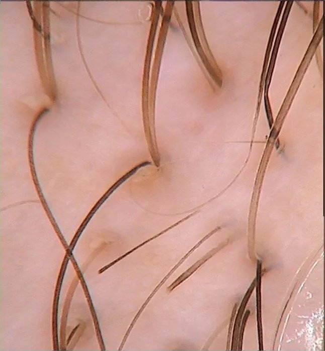 Picture 3