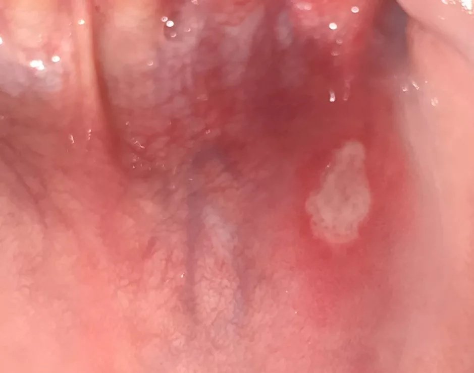 Picture 3