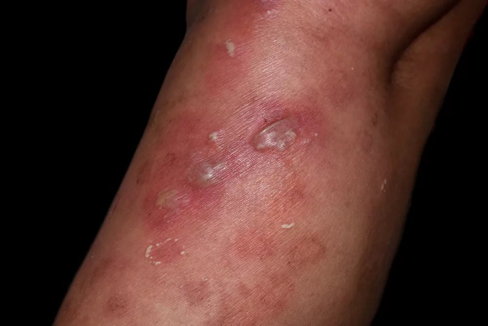 Picture 3