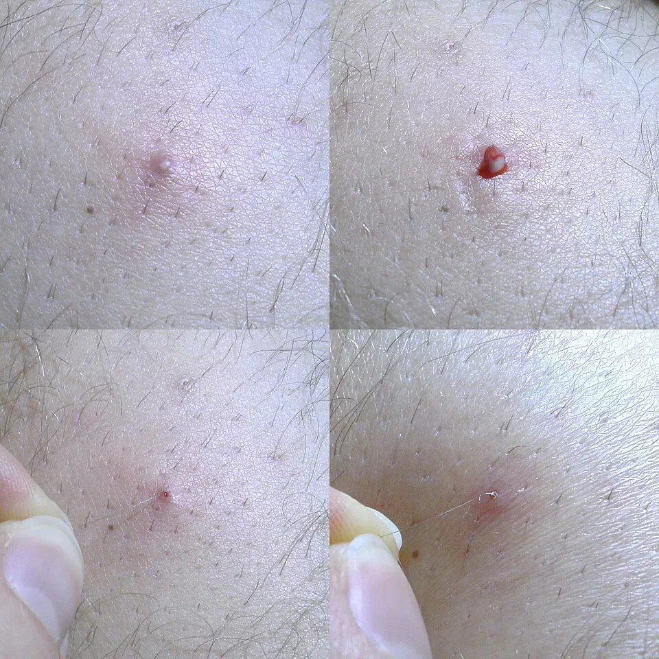 Picture 3
