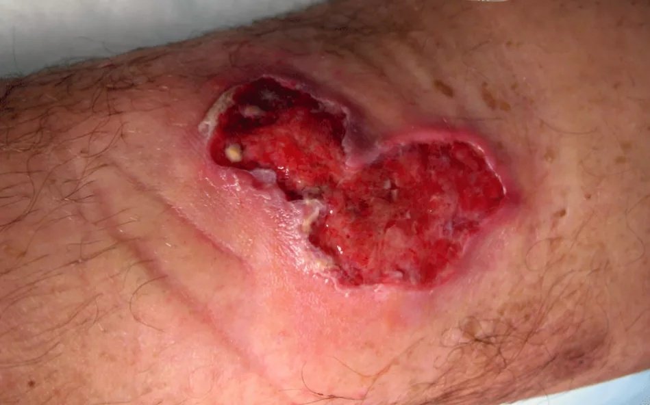 Picture 3