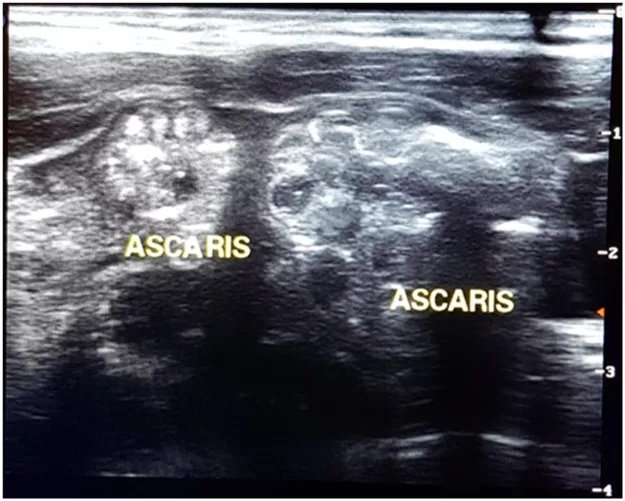 Picture 3