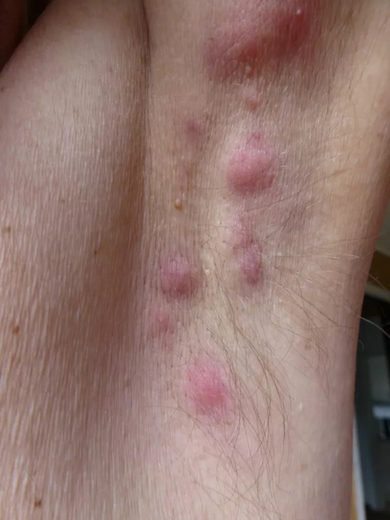 Picture 3