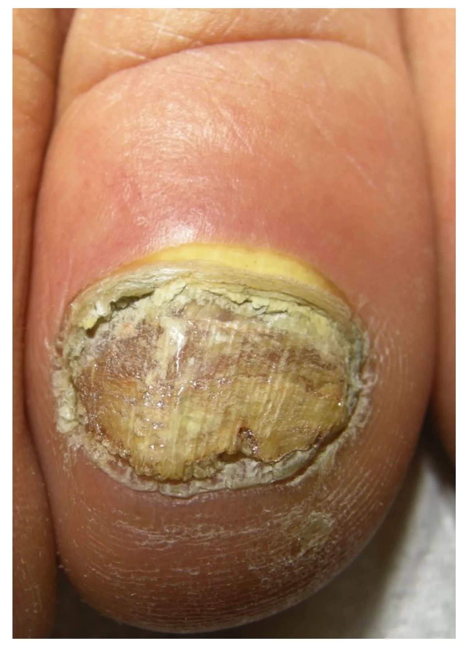 Picture 4