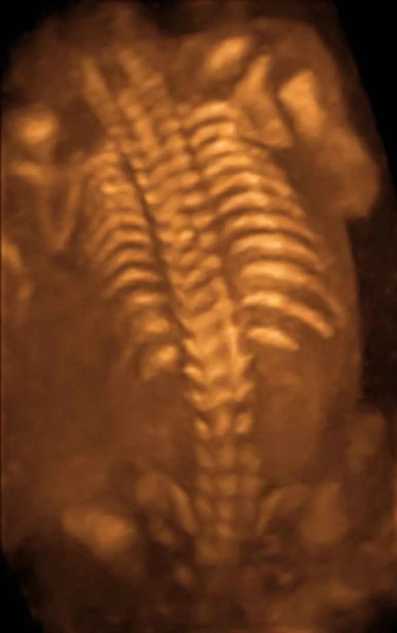 Picture 4
