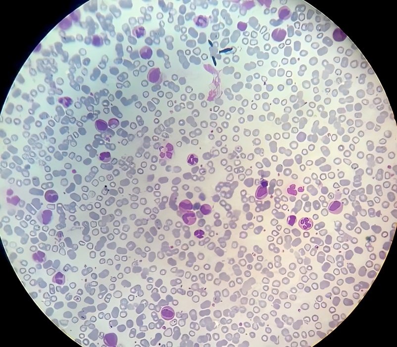 Picture 4