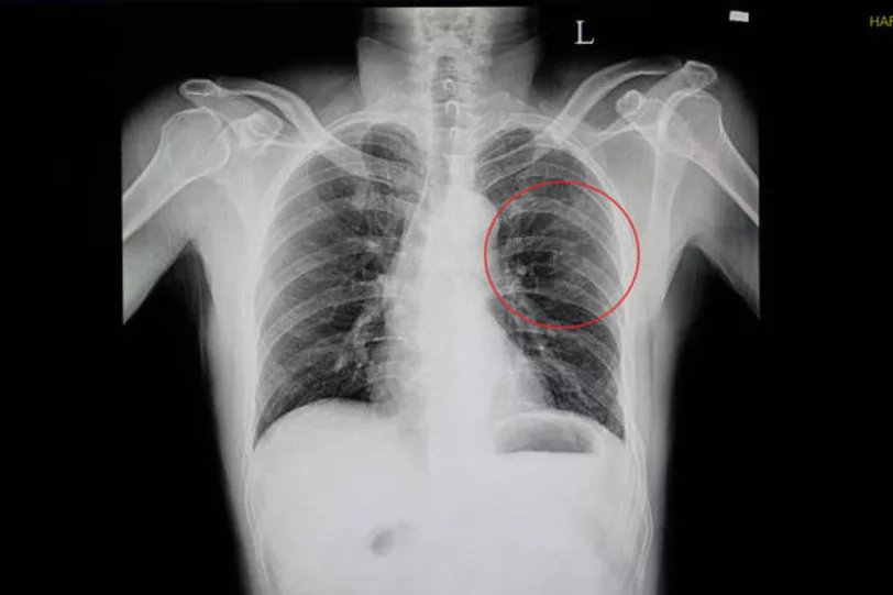 Picture 4