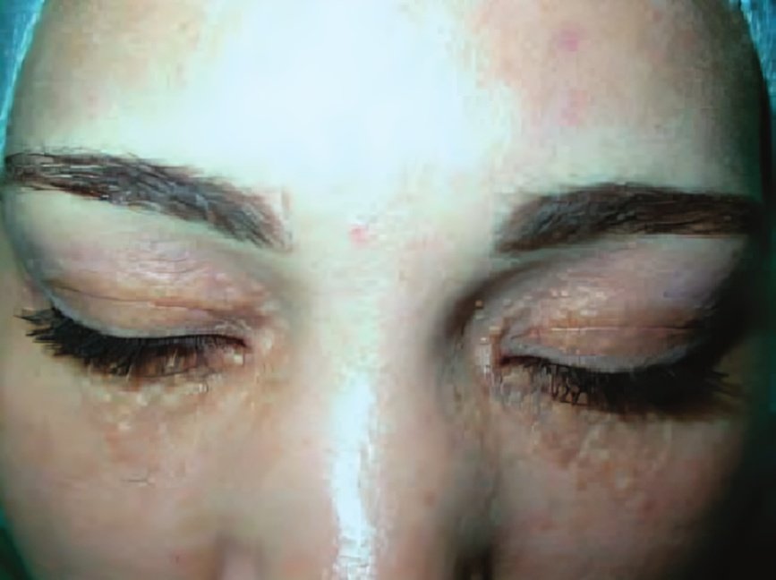 Picture 5