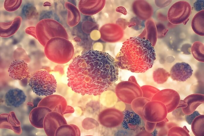 waldenstrom-macroglobulinemia-causes-sym