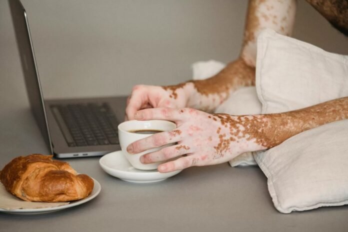 what-causes-vitiligo-a-complete-guide-to